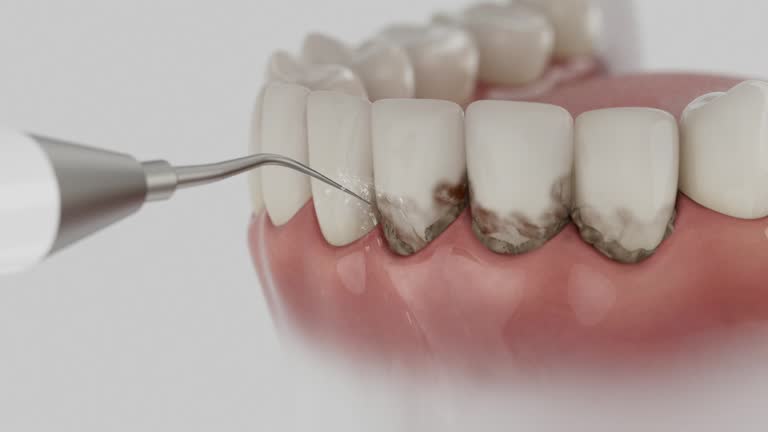 Reliable Dental Implants contractor in Clay County County, WV by Dentist Open Now